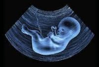 تولد ۱۲ نوزاد معلول در یک مرکز برای ممنوعیت غربالگری توسط وزارت بهداشت