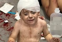 نیروی هوایی اسرائیل، بیمارستانی در شهر غزه را بمباران کرد / منابع غیر رسمی: بیش از هزار نفر کشته شدند