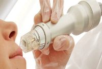 دستگاه جوانساز RF Fractional برند Sanhe چیست؟(۶مزایا + قیمت)