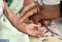 رکورد شکنی سیستان و بلوچستان در سوء تغذیه و ناامنی غذایی