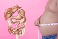 عوارض بای پس معده را قبل از جراحی بشناسید